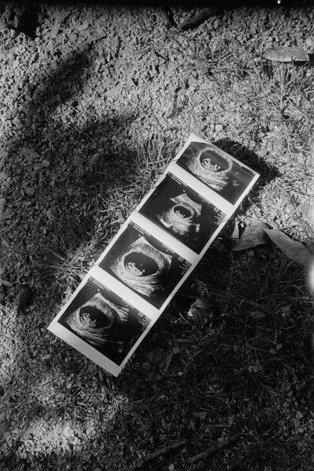 Imagen numero 1 del servicio Psicologia Perinatal
