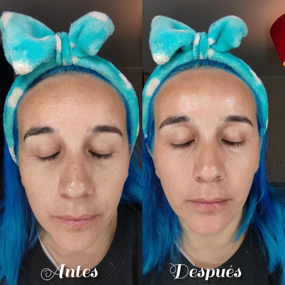 Imagen numero 2 del servicio Limpieza facial profunda