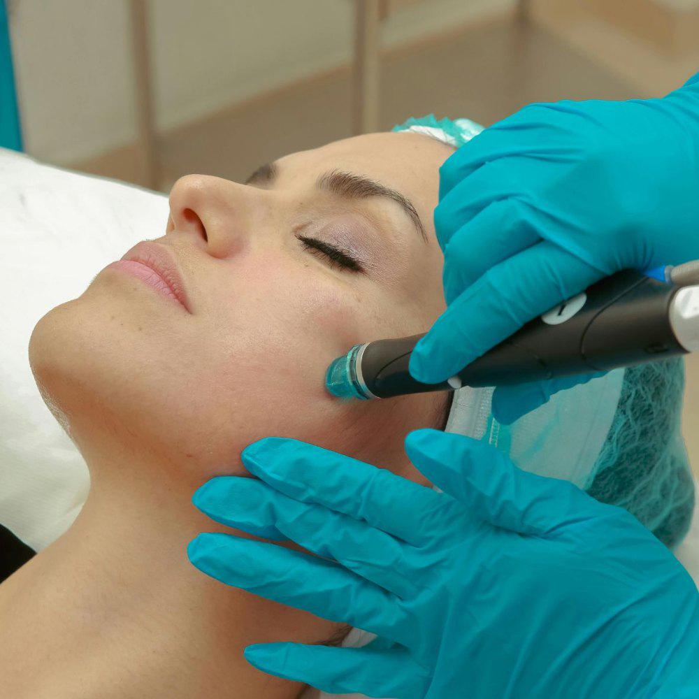 Imagen numero 2 del servicio Limpieza Facial Profunda