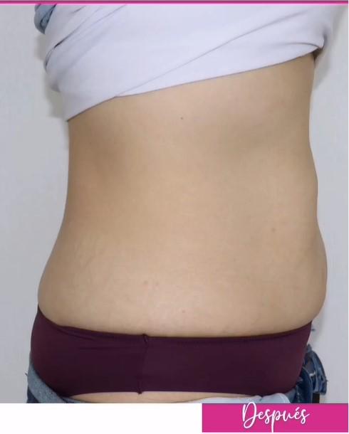Imagen numero 2 del servicio Lipoenzimática