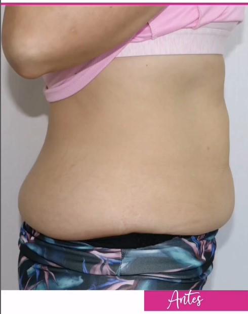 Imagen numero 1 del servicio Lipoenzimática