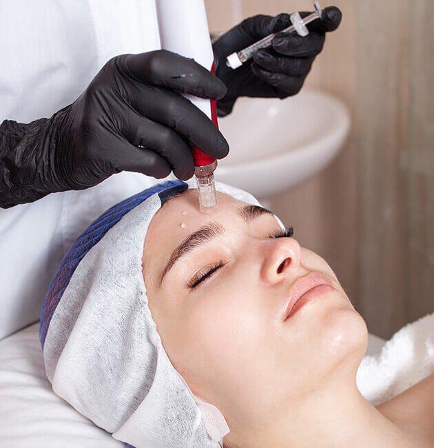 Imagen numero 1 del servicio Microneedling, Terapia de Inducción de Colágeno
