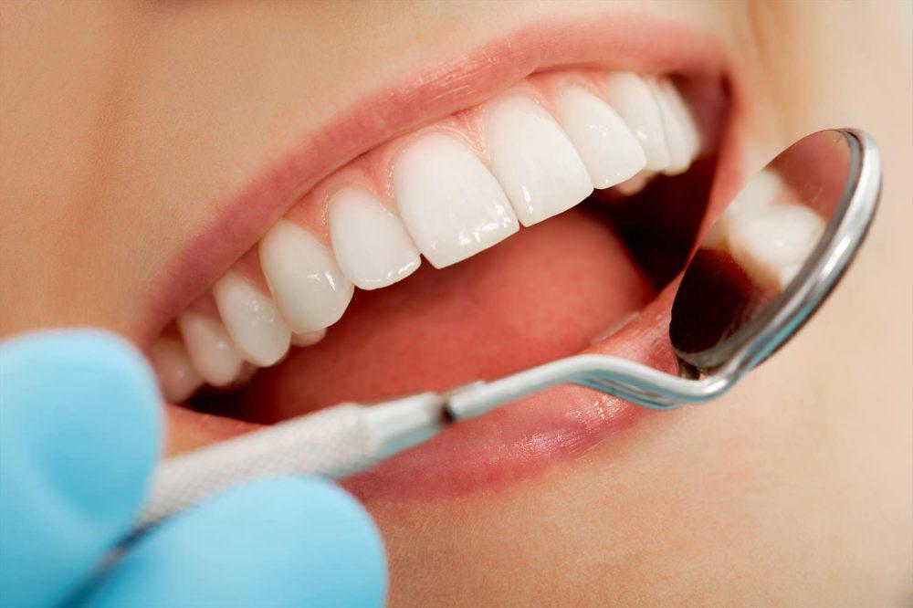 Imagen numero 1 del servicio Limpieza dental ☐ Convenio