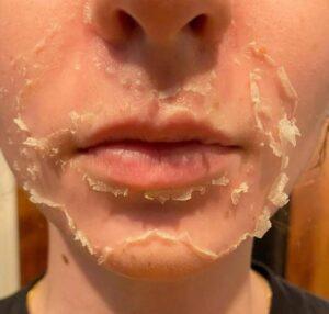 Imagen numero 3 del servicio Tratamiento peeling de algas (ZENA)