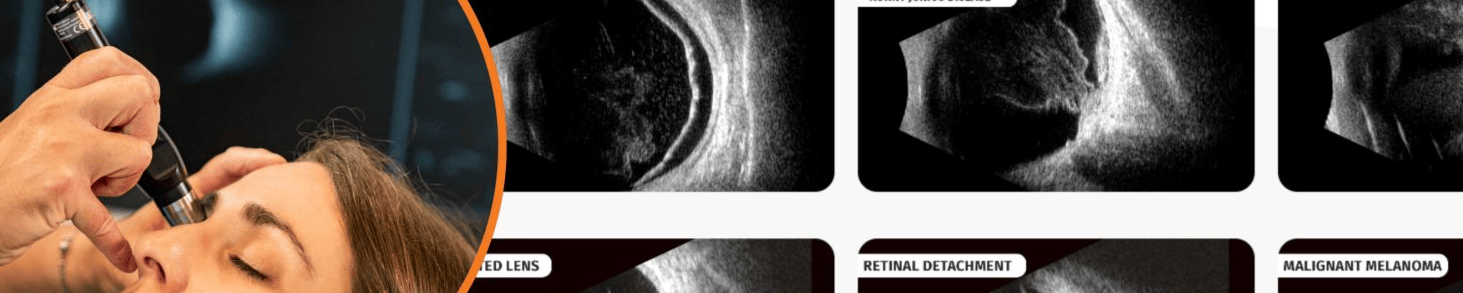 Banner de la store ECOGRAFIA OCULAR UBM
