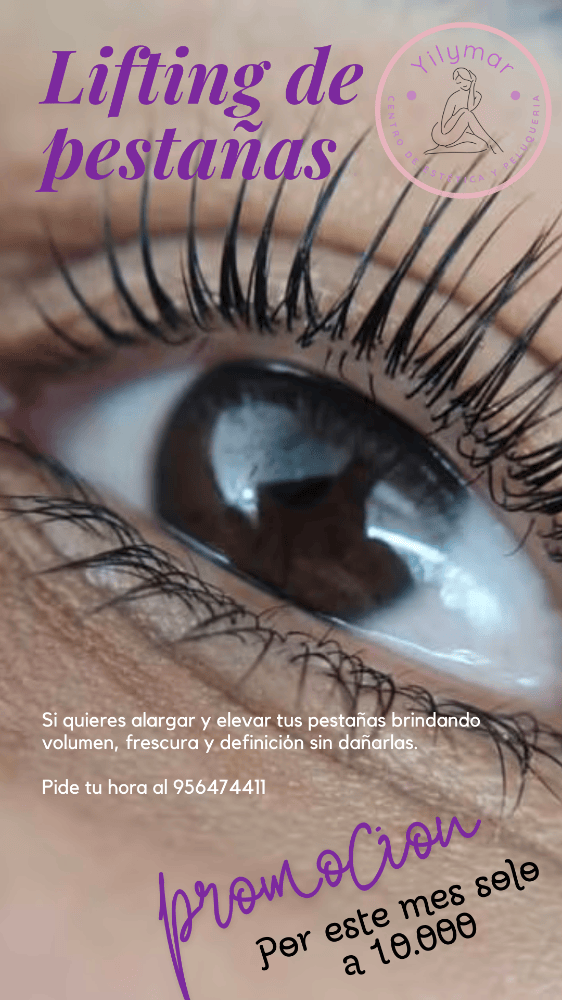 Imagen numero 1 del servicio Lifting de pestañas