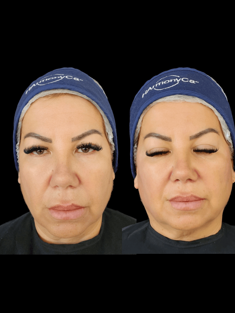 Imagen numero 1 del servicio Bioestimulacion Harmonyca