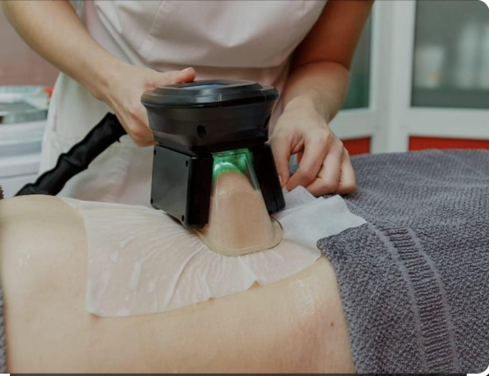 Imagen numero 1 del servicio Tratamiento Criolipolisis