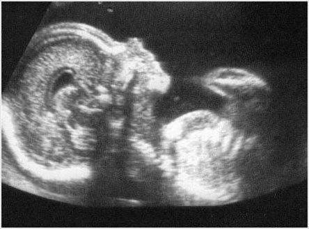 Imagen numero 1 del servicio Ecografia 22-24 semanas + Doppler + Cervicometria