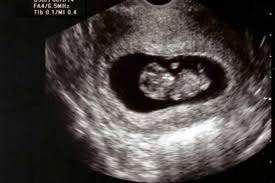 Imagen numero 1 del servicio Ecografía confirmación embarazo