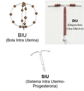 Imagen numero 1 del servicio Insercion, extraccion y recambio de Dispositivo Intrauterino