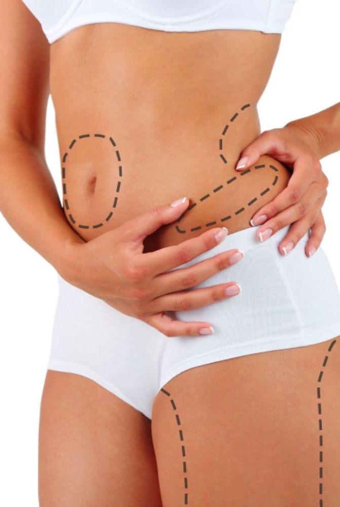Imagen numero 1 del servicio PLAN 2 LIPO SIN CIRUGIA ENZIMÁTICA