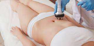 Imagen numero 2 del servicio Radiofrecuencia