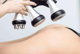Imagen numero 1 del servicio Radiofrecuencia