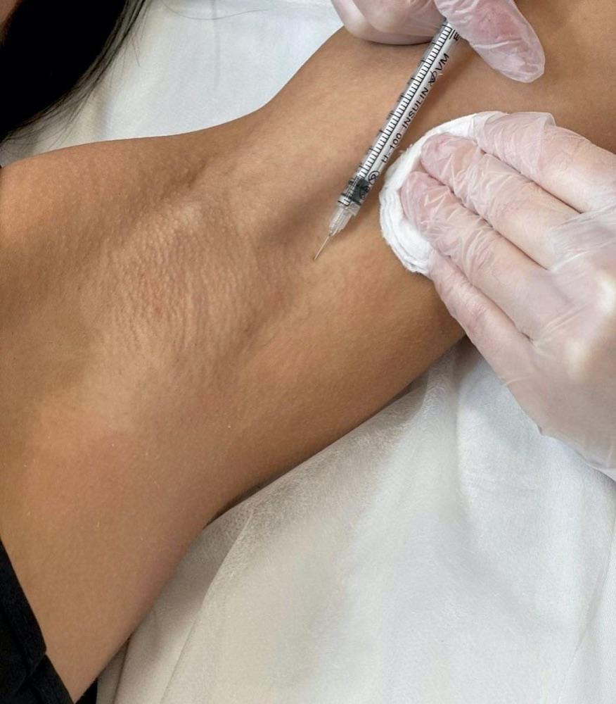 Imagen numero 1 del servicio Botox axilar o palmar para hiperhidrosis.