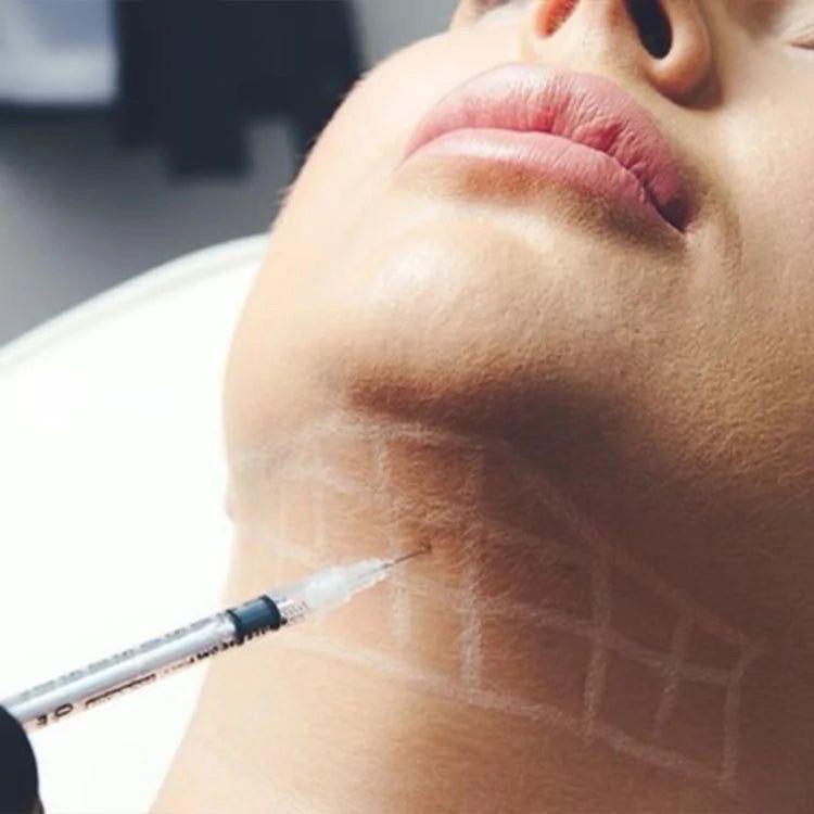 Imagen numero 1 del servicio Lipopapada enzimatica