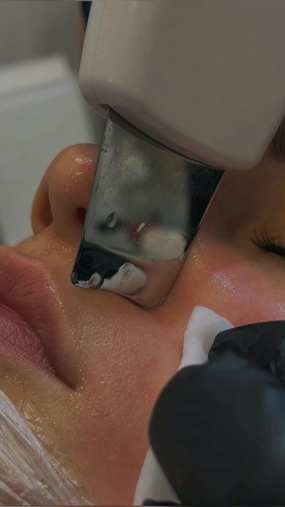 Imagen numero 1 del servicio Limpieza facial adolescente