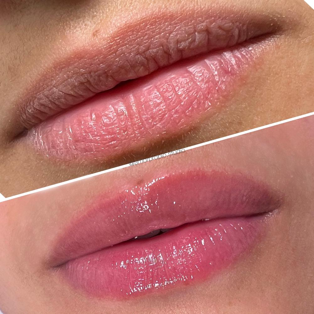Imagen numero 1 del servicio Hydra lips Premium