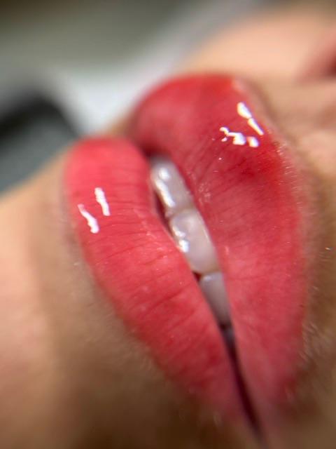 Imagen numero 2 del servicio Hydra lips Premium
