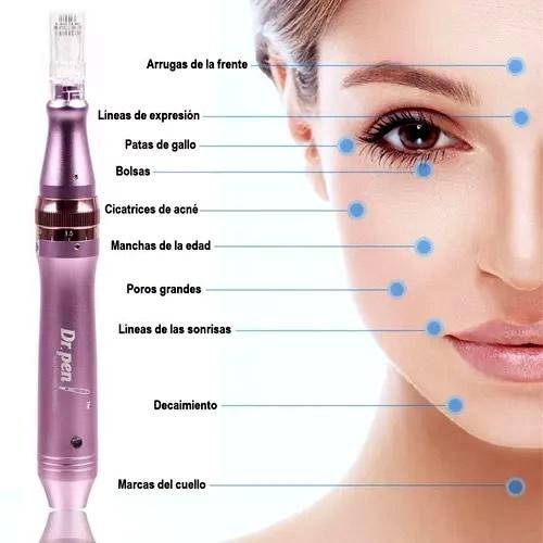Imagen numero 2 del servicio dermapen