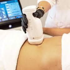 Imagen numero 2 del servicio HIFU + LIPOSONIC