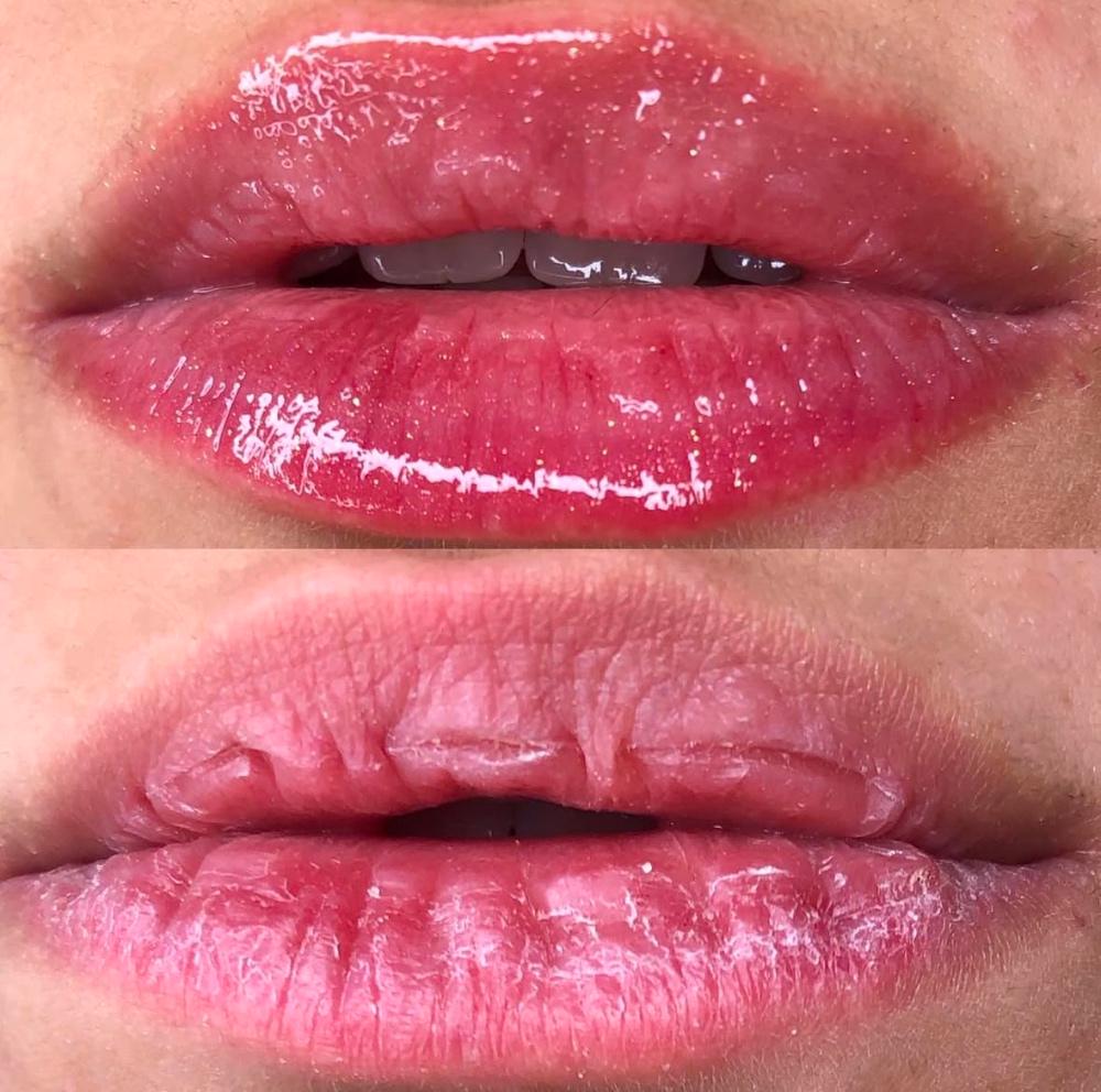Imagen numero 3 del servicio Hydra glow lips / Hidratación de labios