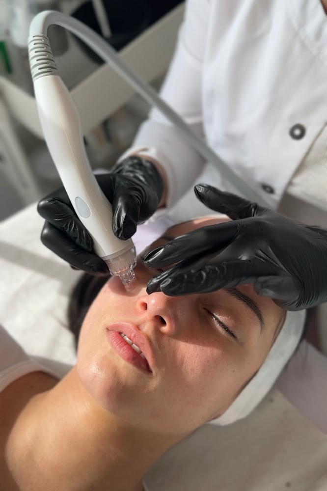 Imagen numero 1 del servicio Hydrafacial