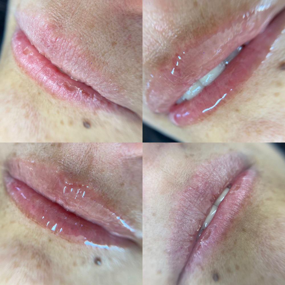 Imagen numero 2 del servicio Hydra glow lips / Hidratación de labios